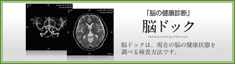 脳ドック